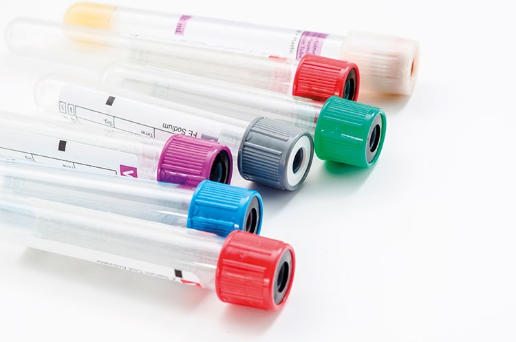 Réactif de laboratoire